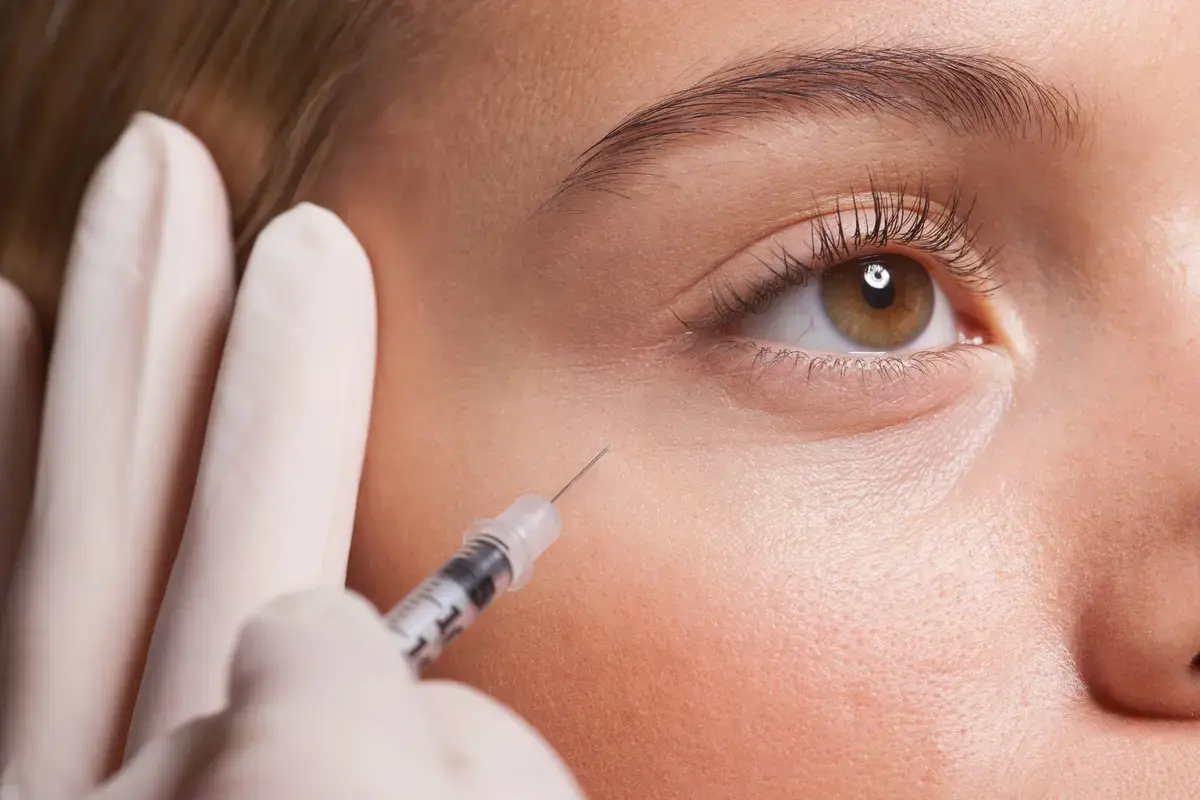 Dermatologii investighează Botox ca tratament inovator pentru acnee